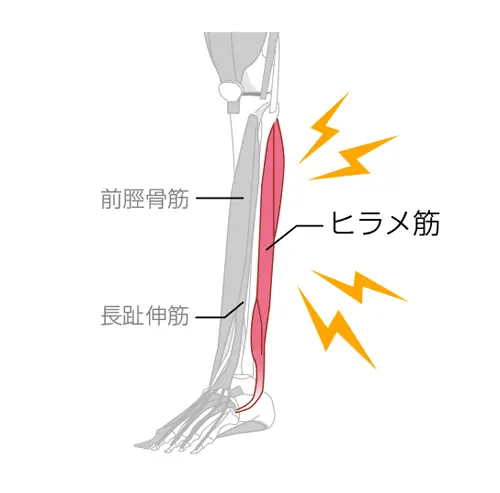 ヒラメ筋図解イラスト