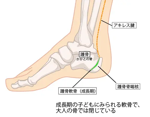 踵の骨イラスト