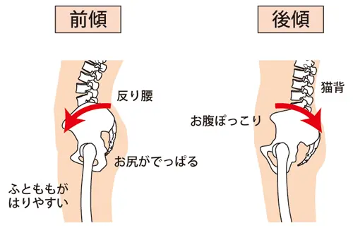 骨盤イラスト