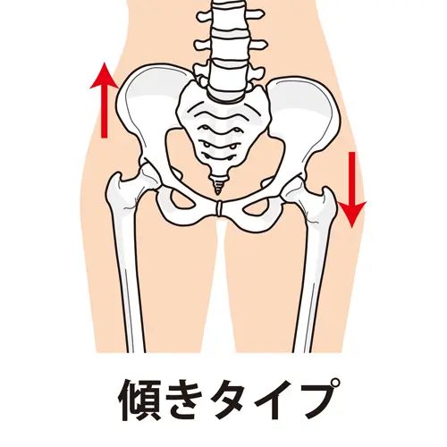 骨盤イラスト